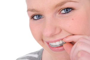 Woman using invisalign clear aligners