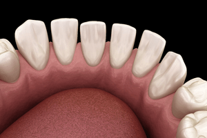 an illustration of gapped teeth