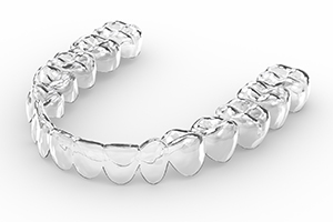 3D render of an Invisalign aligner