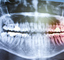 dental x-ray