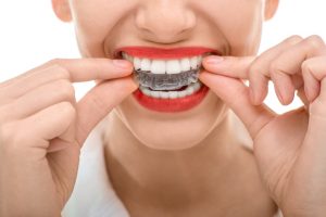 Why should I get Invisalign in Oakton?