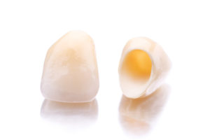 Two beautiful, strong dental crowns